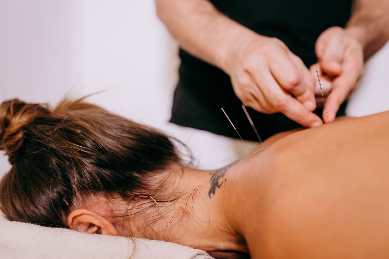 Close-up of hands placing acupuncture needles, representing clinical teaching and training